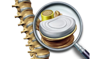 毕义明 12节椎间盘突出康复课【完结】